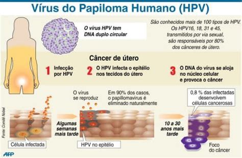 hpv 痣|Infecção por papilomavírus humano (HPV)